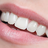 歯の色や形も変えるセラミック矯正
